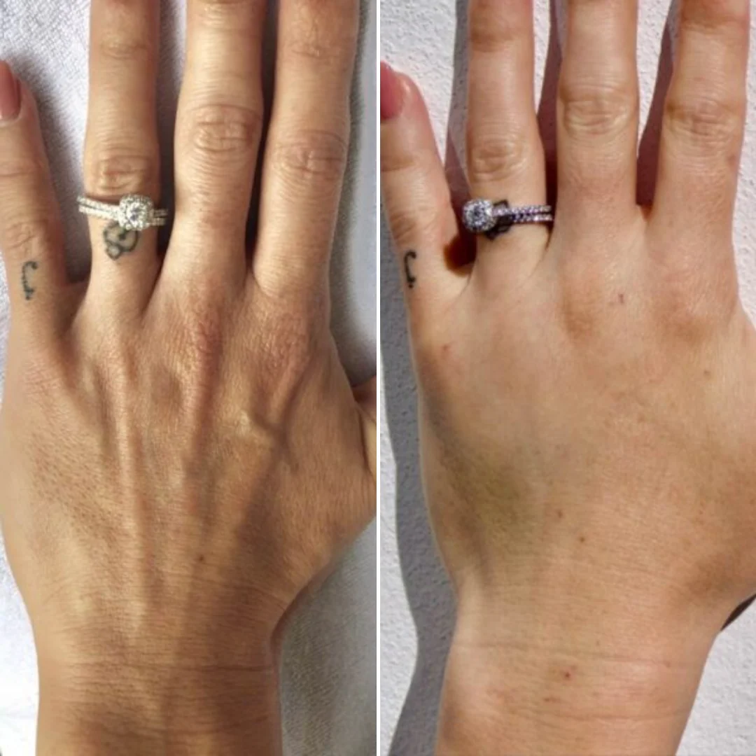 Hand Rejuvenation Ritual