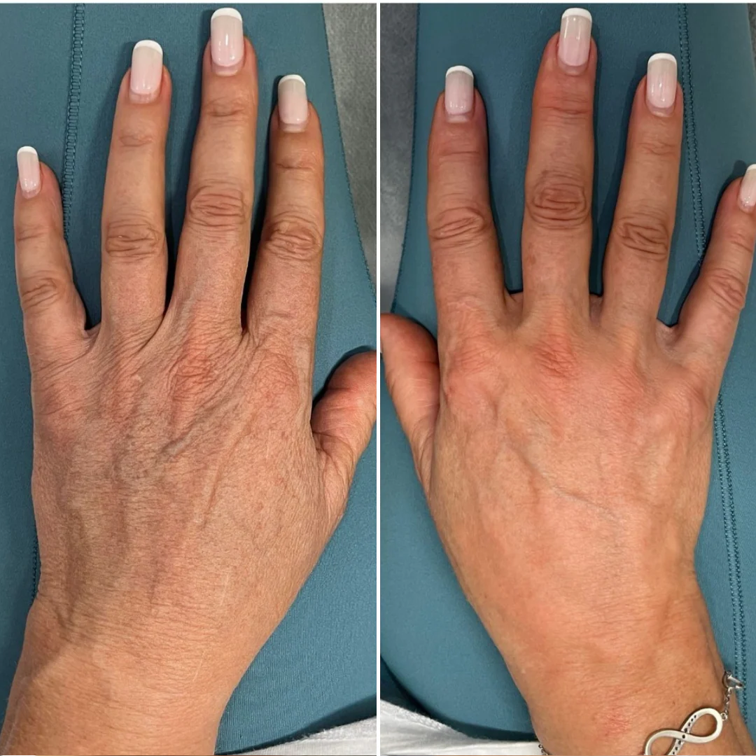 Hand Rejuvenation Ritual